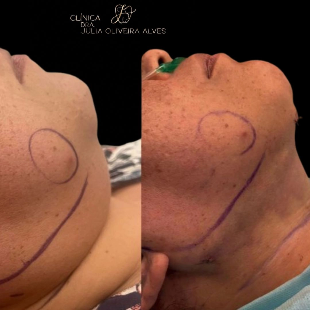 Manicure antes e depois pés e mão podóloga estética rosê.jpg