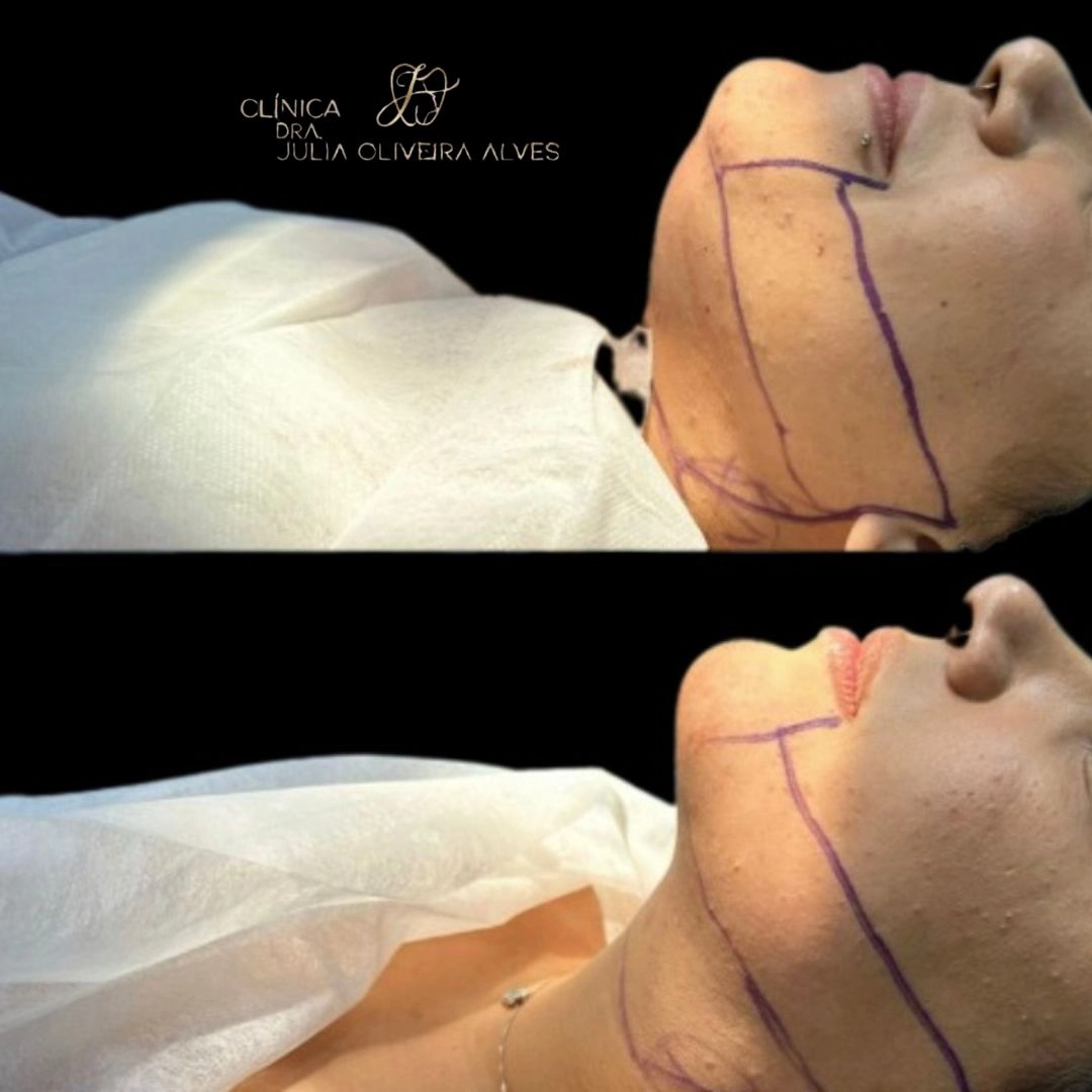 Manicure antes e depois pés e mão podóloga estética rosê.zip - 30